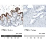 Atlas Antibodies Anti-KRT20 Antibody