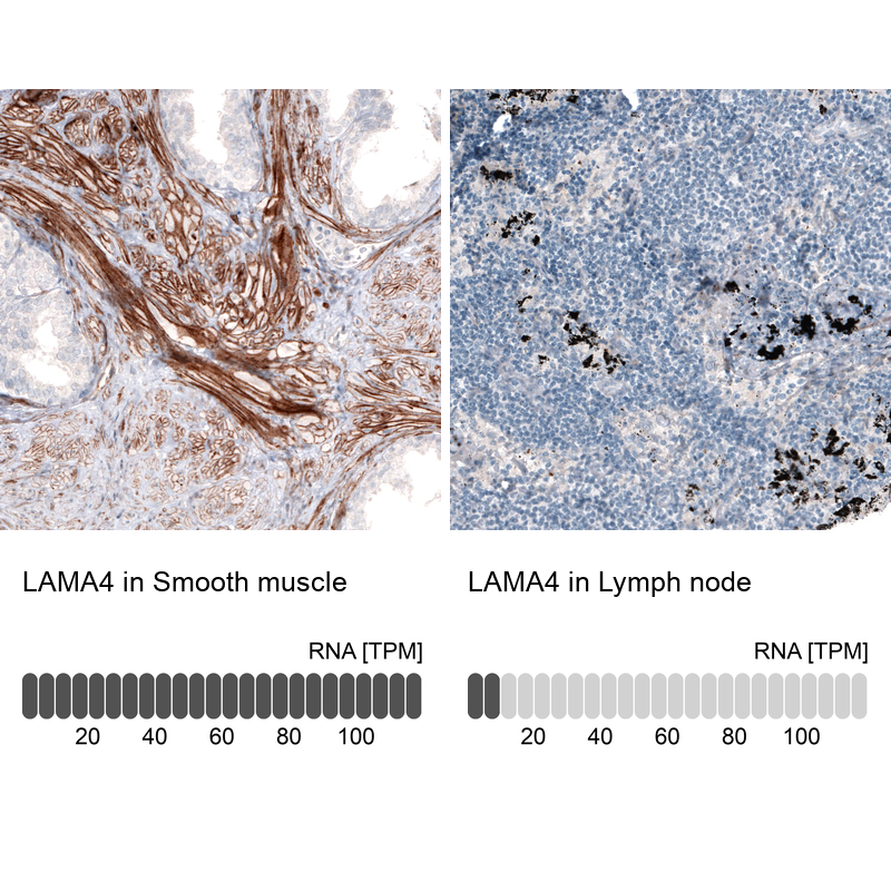 Atlas Antibodies Anti-LAMA4 Antibody