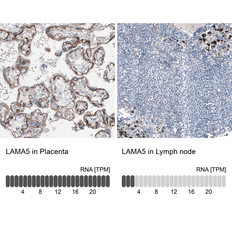 Atlas Antibodies Anti-LAMA5 Antibody