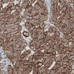 Atlas Antibodies Anti-LAMB2 Antibody