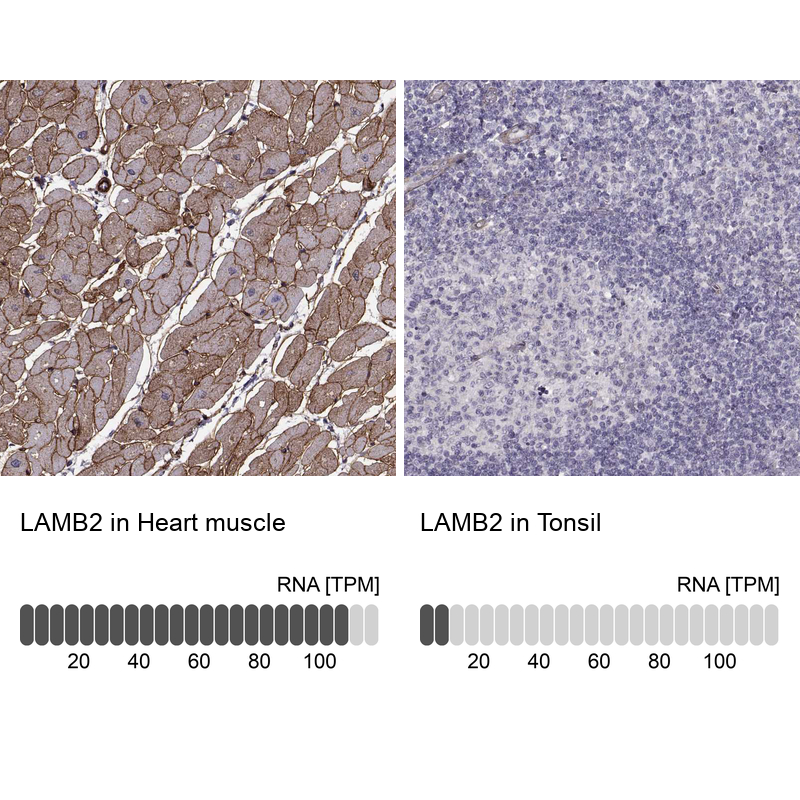 Atlas Antibodies Anti-LAMB2 Antibody