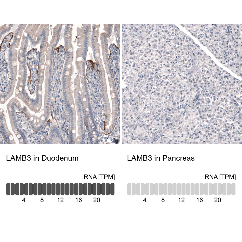 Atlas Antibodies Anti-LAMB3 Antibody