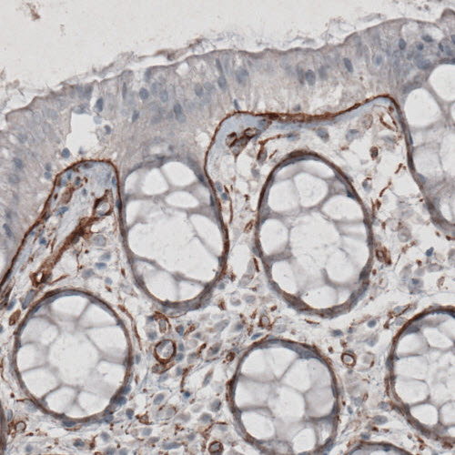 Atlas Antibodies Anti-LAMC1 Antibody