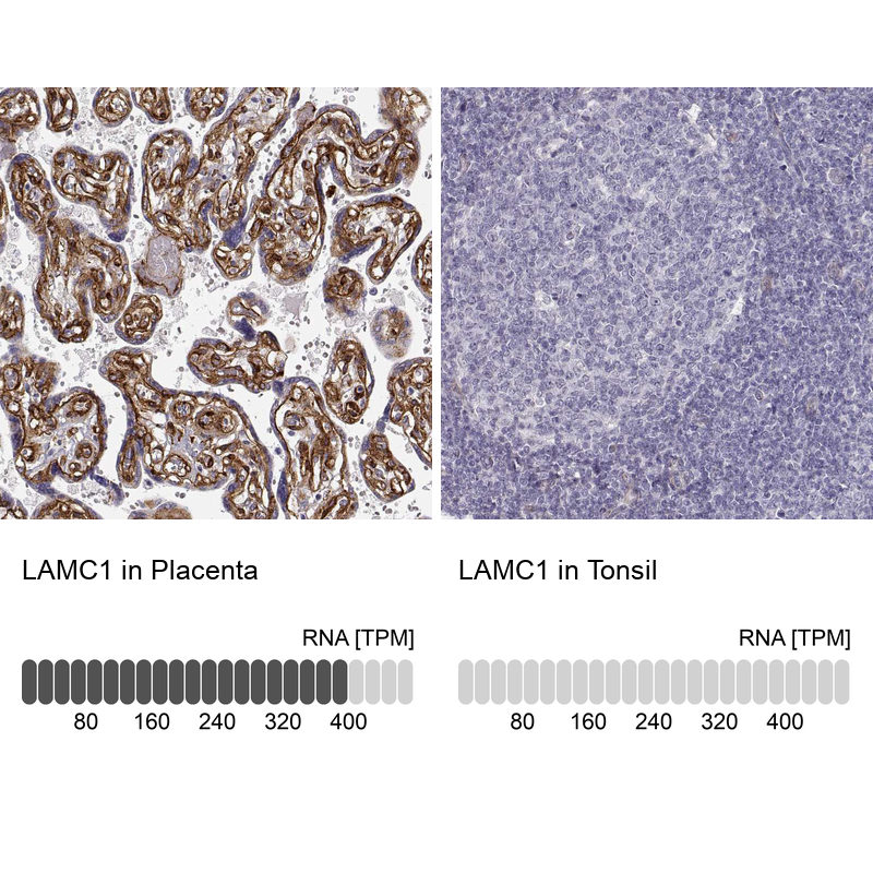 Atlas Antibodies Anti-LAMC1 Antibody