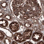 Atlas Antibodies Anti-LAMP1 Antibody