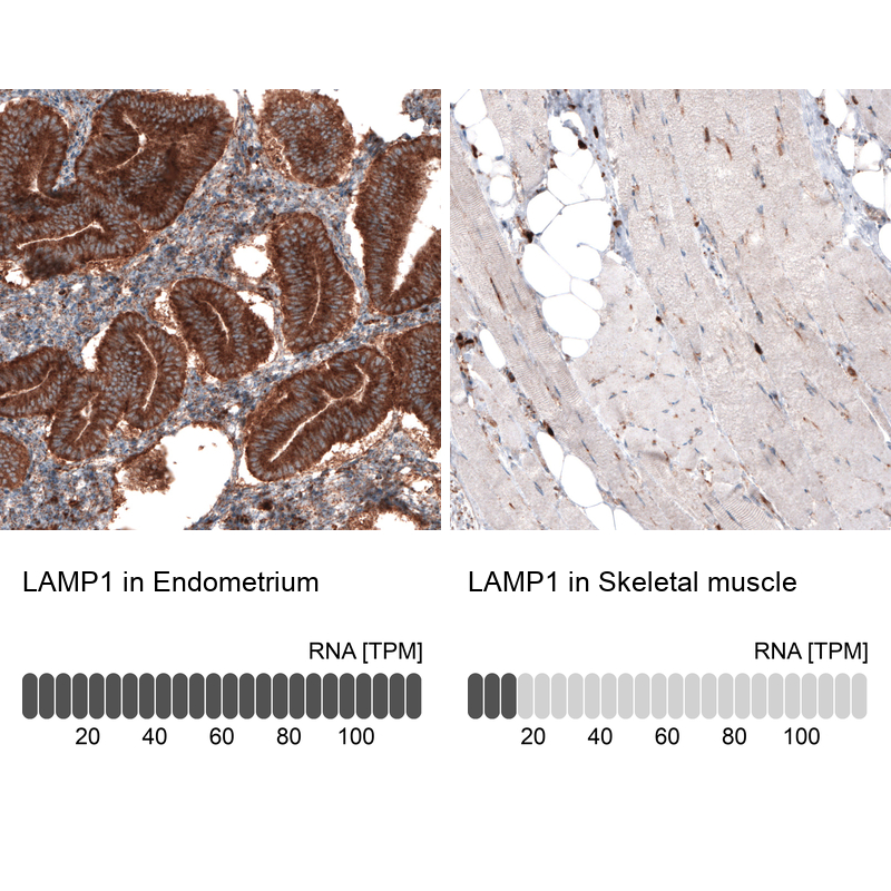 Atlas Antibodies Anti-LAMP1 Antibody