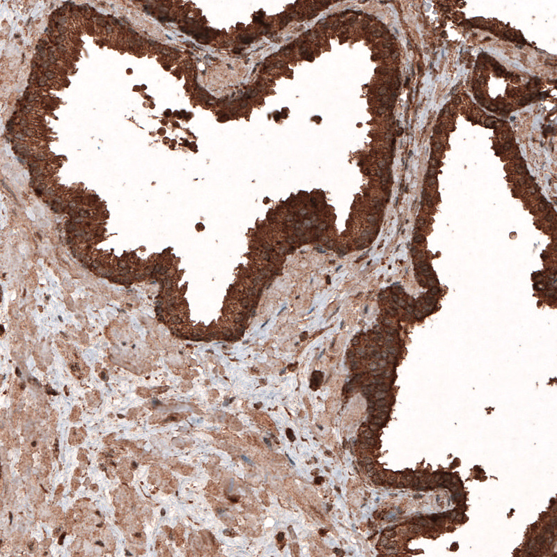 Atlas Antibodies Anti-LAMP1 Antibody