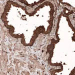 Atlas Antibodies Anti-LAMP1 Antibody