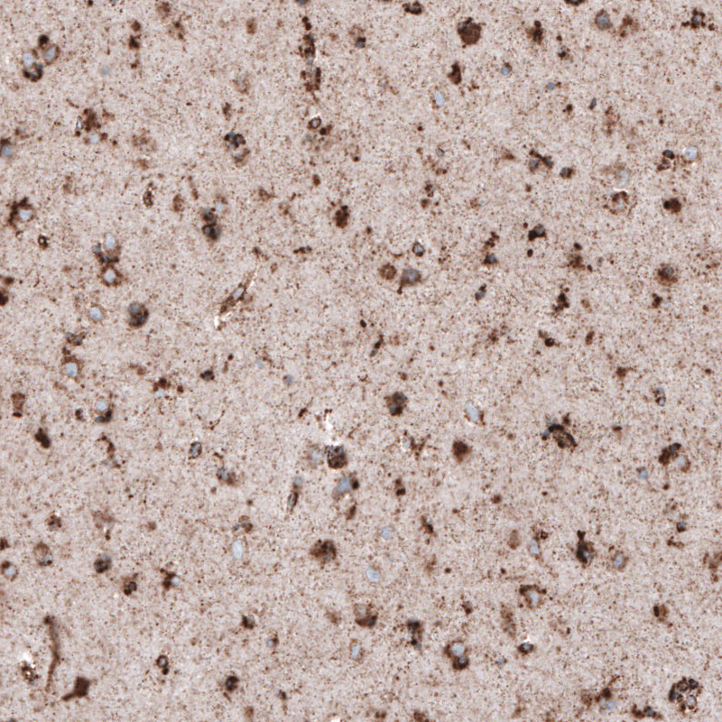 Atlas Antibodies Anti-LAMP1 Antibody