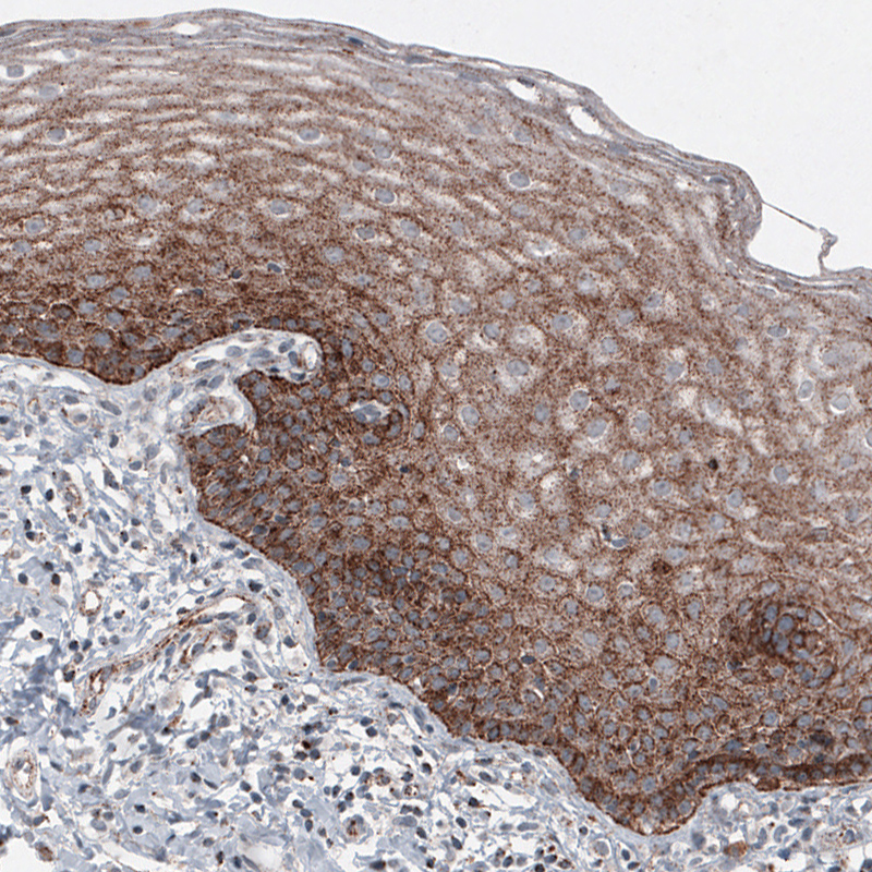 Atlas Antibodies Anti-LAMP1 Antibody