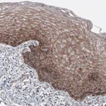 Atlas Antibodies Anti-LAMP1 Antibody