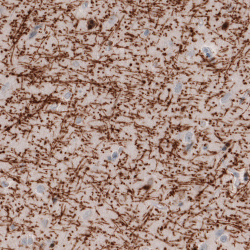 Atlas Antibodies Anti-MBP Antibody