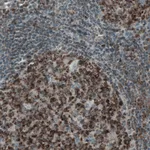 Atlas Antibodies Anti-MCL1 Antibody