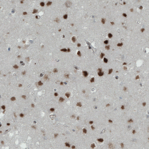 Atlas Antibodies Anti-MEF2C Antibody