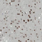 Atlas Antibodies Anti-MEF2C Antibody