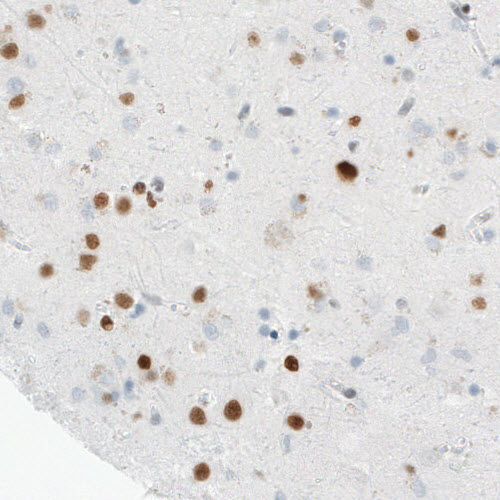 Atlas Antibodies Anti-MEF2C Antibody