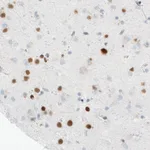 Atlas Antibodies Anti-MEF2C Antibody