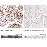 Atlas Antibodies Anti-METTL14 Antibody