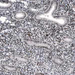 Atlas Antibodies Anti-METTL14 Antibody