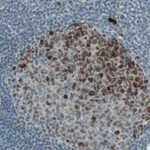 Atlas Antibodies Anti-MKI67 Antibody