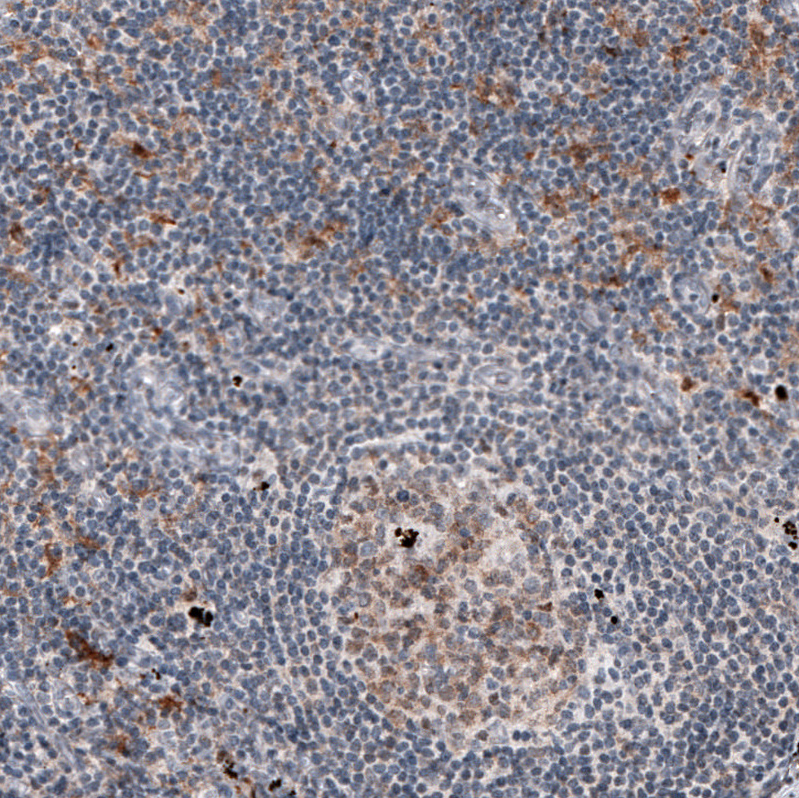 Atlas Antibodies Anti-MKL1 Antibody