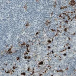 Atlas Antibodies Anti-MMP9 Antibody