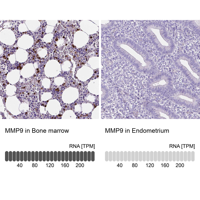Atlas Antibodies Anti-MMP9 Antibody