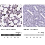 Atlas Antibodies Anti-MMP9 Antibody