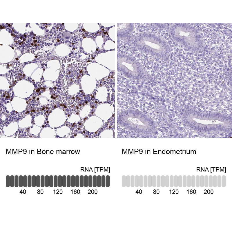 Atlas Antibodies Anti-MMP9 Antibody