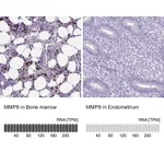 Atlas Antibodies Anti-MMP9 Antibody