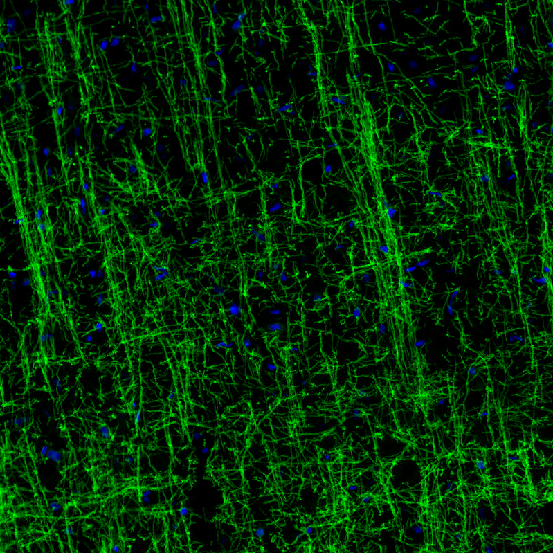 Atlas Antibodies Anti-MOG Antibody