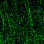 Atlas Antibodies Anti-MOG Antibody