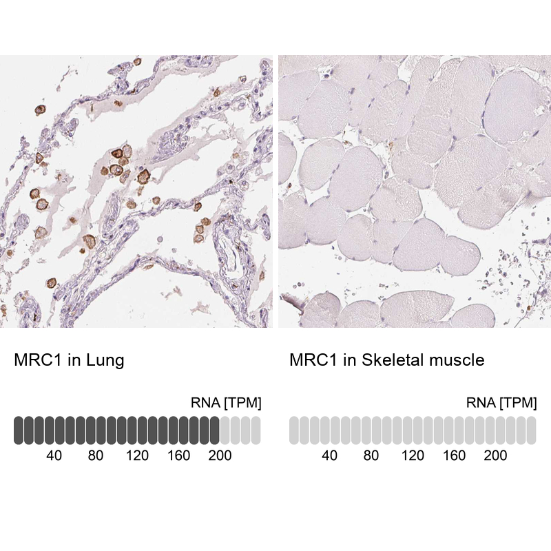 Atlas Antibodies Anti-MRC1 Antibody