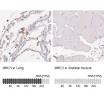 Atlas Antibodies Anti-MRC1 Antibody