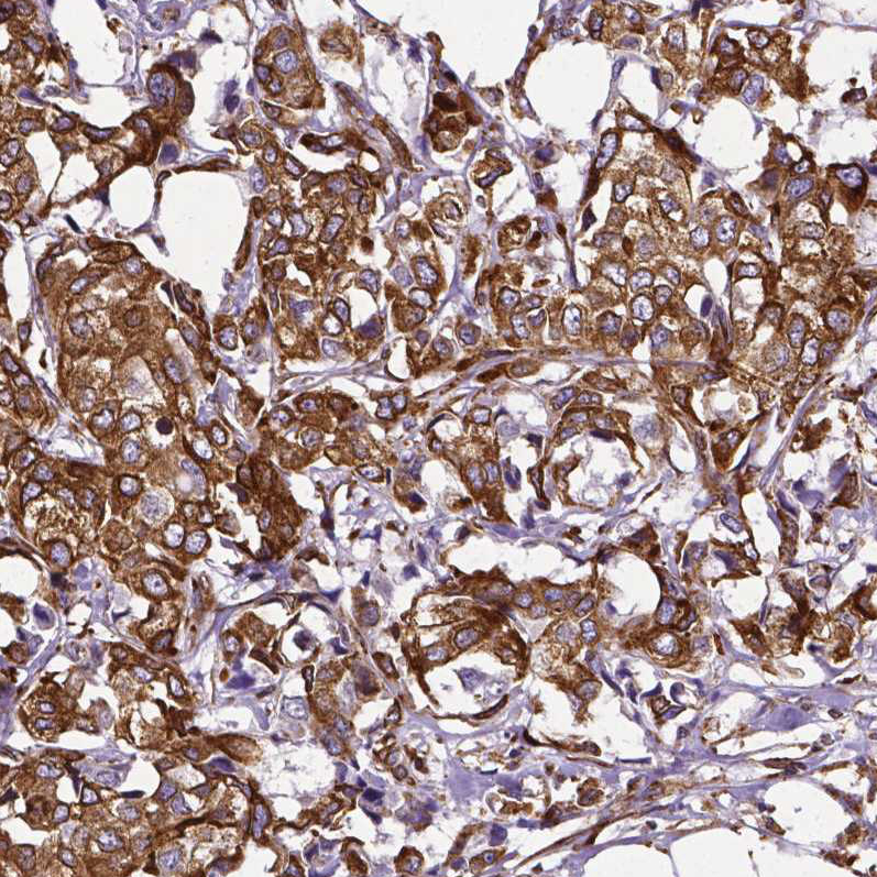 Atlas Antibodies Anti-MTDH Antibody