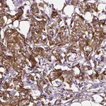 Atlas Antibodies Anti-MTDH Antibody