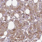 Atlas Antibodies Anti-MTDH Antibody