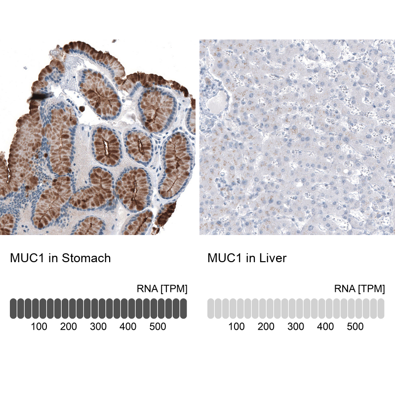 Atlas Antibodies Anti-MUC1 Antibody