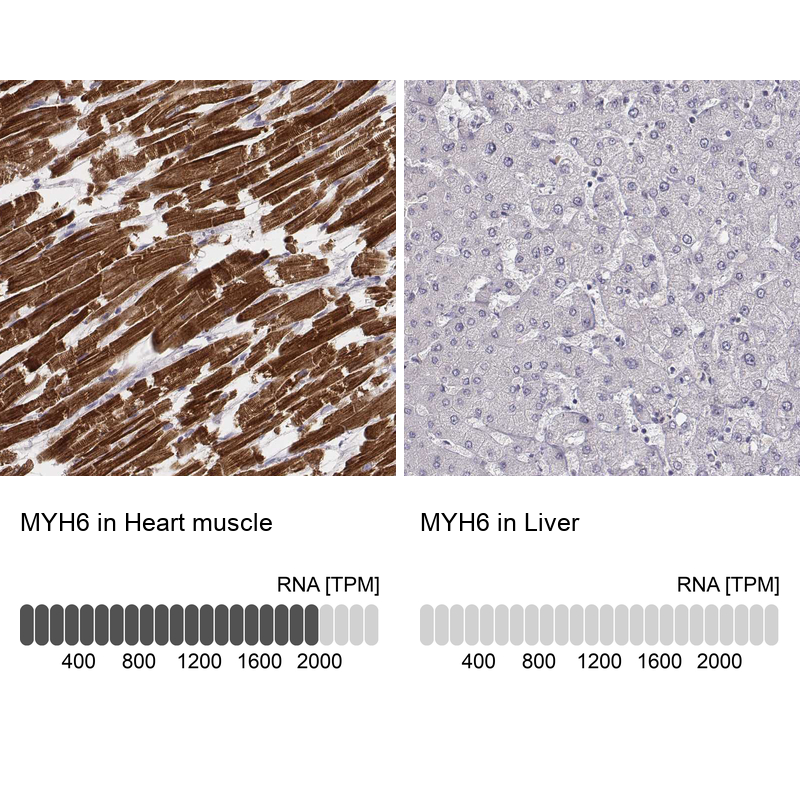 Atlas Antibodies Anti-MYH6 Antibody