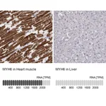 Atlas Antibodies Anti-MYH6 Antibody