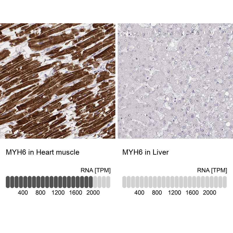 Atlas Antibodies Anti-MYH6 Antibody