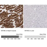 Atlas Antibodies Anti-MYH6 Antibody