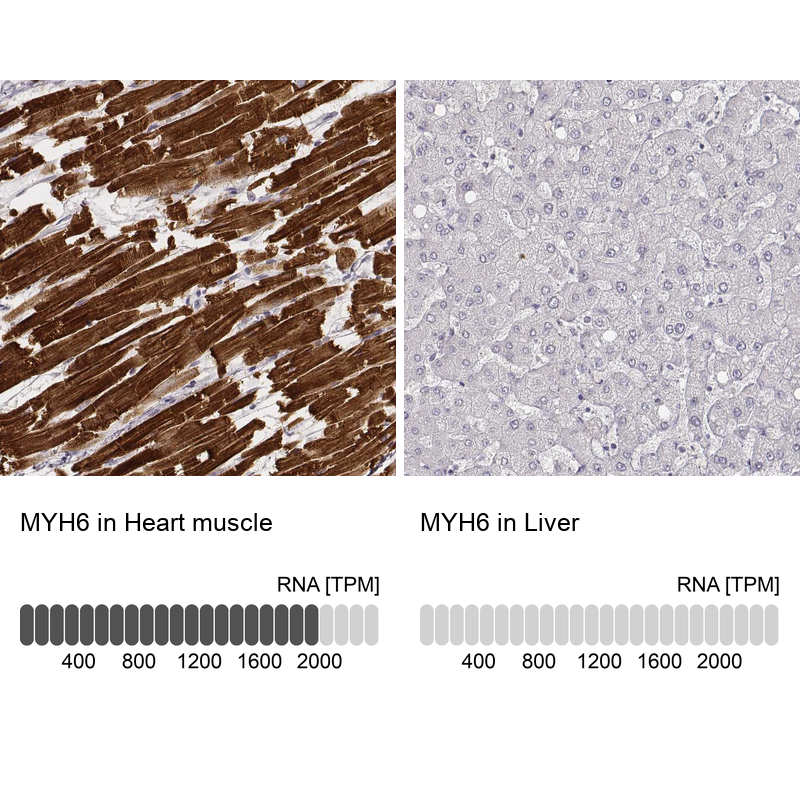 Atlas Antibodies Anti-MYH6 Antibody