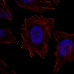 Atlas Antibodies Anti-MYO10 Antibody
