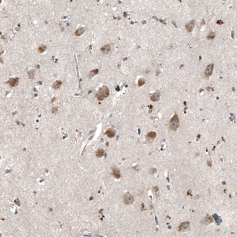 Atlas Antibodies Anti-MYO10 Antibody