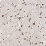Atlas Antibodies Anti-MYO10 Antibody