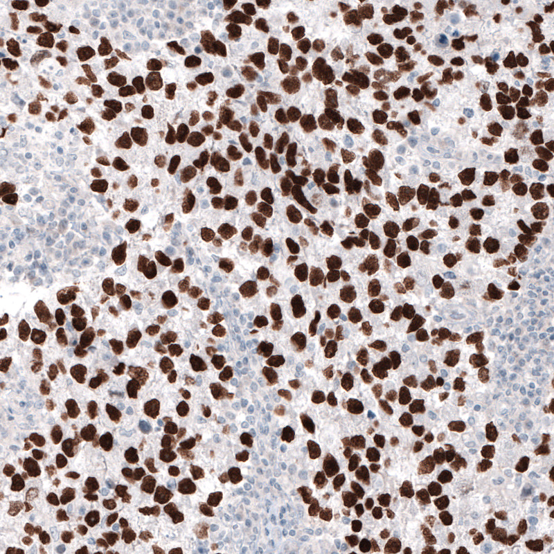 Atlas Antibodies Anti-NANOG Antibody