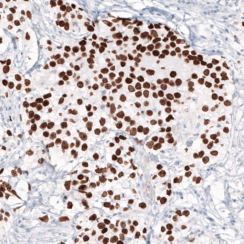 Atlas Antibodies Anti-NANOG Antibody