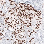 Atlas Antibodies Anti-NANOG Antibody