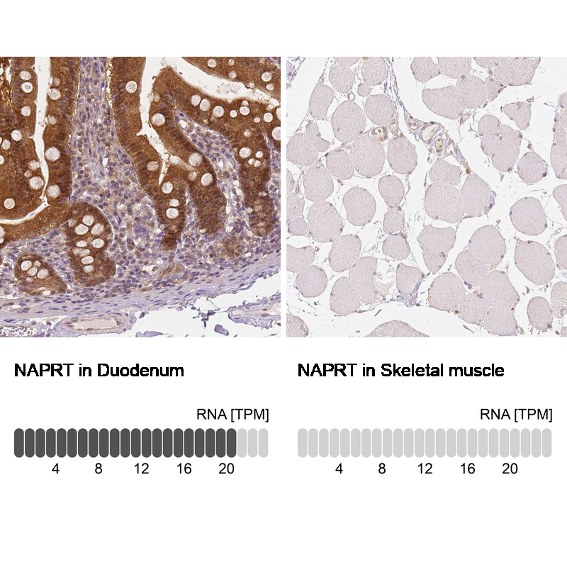 Atlas Antibodies Anti-NAPRT Antibody